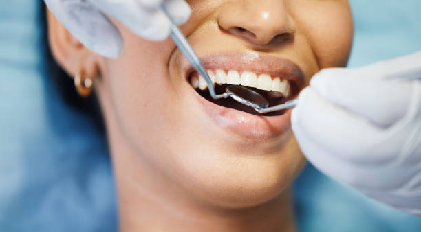 Best Emergency Treatment for Dental Infections or Abscesses in New Holland, PA